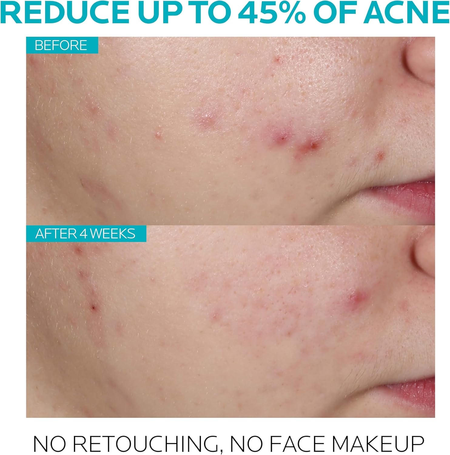 La Roche Posay Effaclar Serum - 30ml/1.01oz